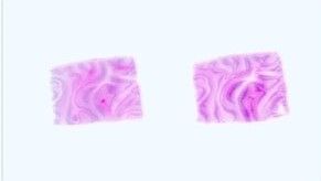 Paraffin Tissue Section - Human Adult Normal: Brain: Thalamus